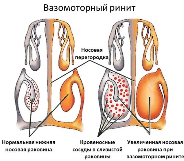 Виброцил для детей: инструкция по применению