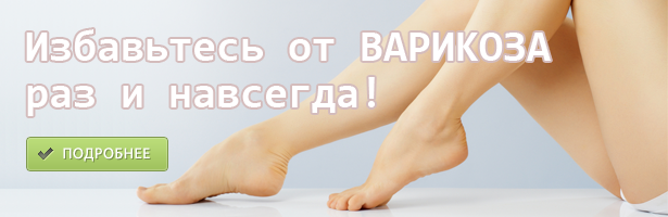 Тромбоз стопы симптомы фото - Все про варикоз