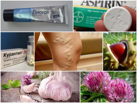 Препараты и народные средства для разжижения крови при варикозе