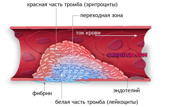 Антикоагулянты – механизм действия, список препаратов