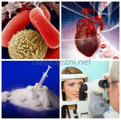 От чего лопаются сосуды в глазах: причины и профилактика