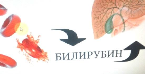 Повышенный билирубин в крови: причины и лечение