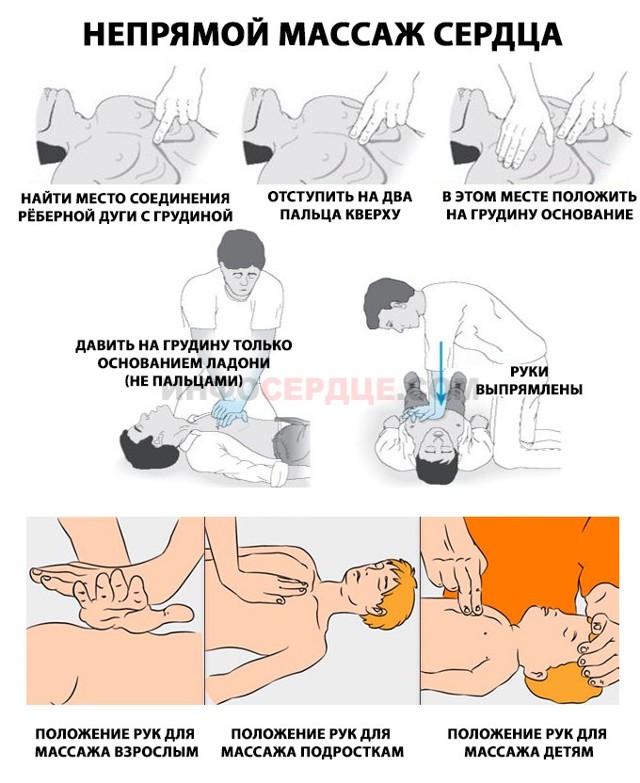 Первая помощь при острой сосудистой недостаточности