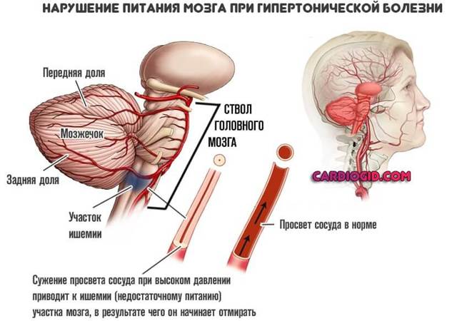 Милдронат - применение, инструкция, показания