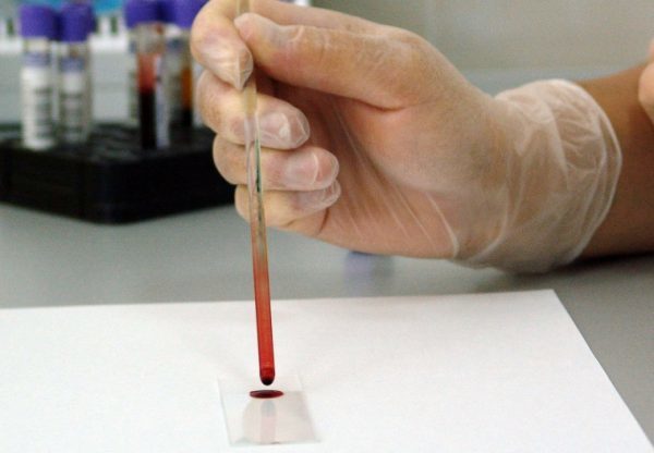 Как повысить гемоглобин в крови – продукты при низком гемоглобине