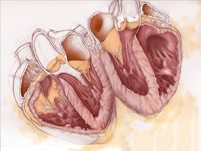 Учащенное сердцебиение - Стоит ли переживать???