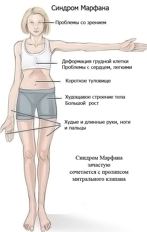 Приобретенный порок сердца