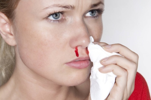 Как остановить носовое кровотечение - Лечение кровотечений