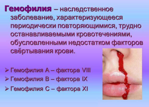 Гемофилия: ген, признаки и лечение. Гемофилия у детей и взрослых.