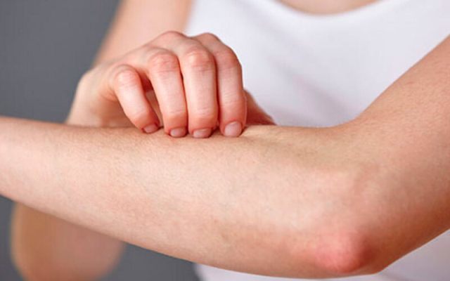 Аллергия после приема антибиотиков лечение — Аллергия