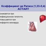 Трансаминаза повышена причины - Лечение печени