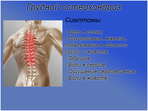 Симптомы боли в сердце при остеохондрозе грудного отдела