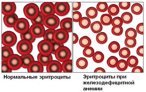Болит голова и идет кровь из носа