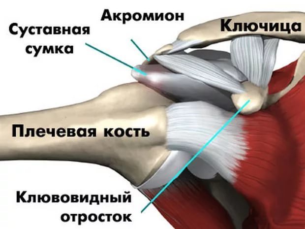 Боль в ключице, болит правая или левая ключица