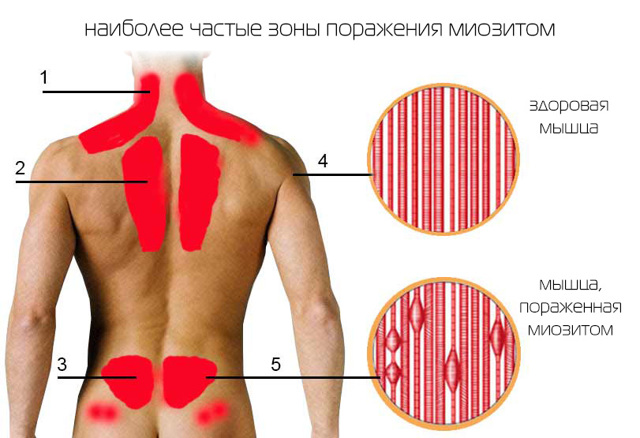УЛЬТРАЗВУКОВАЯ ОЦЕНКА ДИНАМИКИ КРОВОТОКА В ПОЗВОНОЧНЫХ АРТЕРИЯХ ПРИ ПОВОРОТАХ ГОЛОВЫ - Фундаментальные исследования (научный журнал)