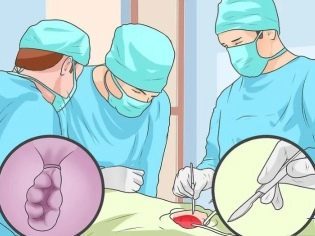 Геморрой при беременности - чем и как лечить геморрой беременной?