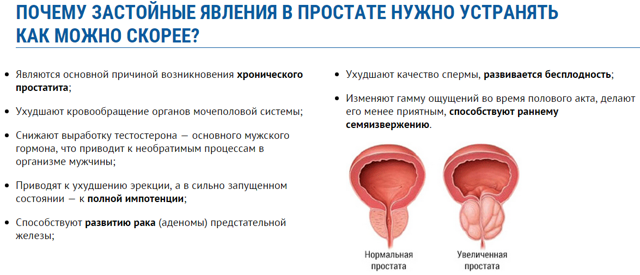 Застой крови в малом тазу у женщин и мужчин: симптомы, лечение, причины