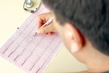 Онлайн-курс ЭКГ: ЧСС, способы ее подсчета