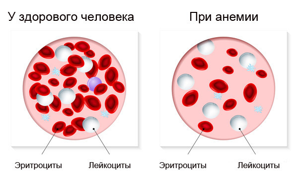 Щелочная фосфатаза в анализе крови (ЩФ): норма у женщин и мужчин, причины повышенных и пониженных значений