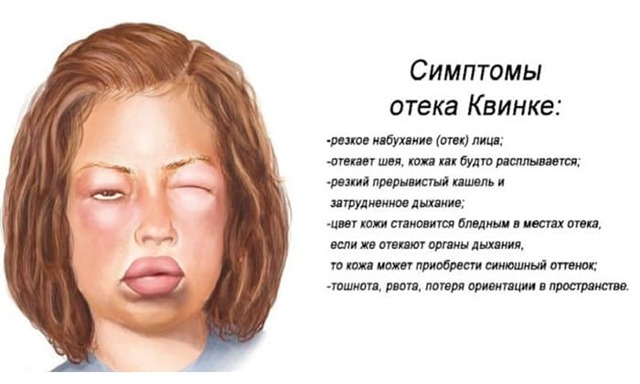 Таблетки Комбилипен ТАБС – инструкция к препарату, цена, аналоги и отзывы о применении