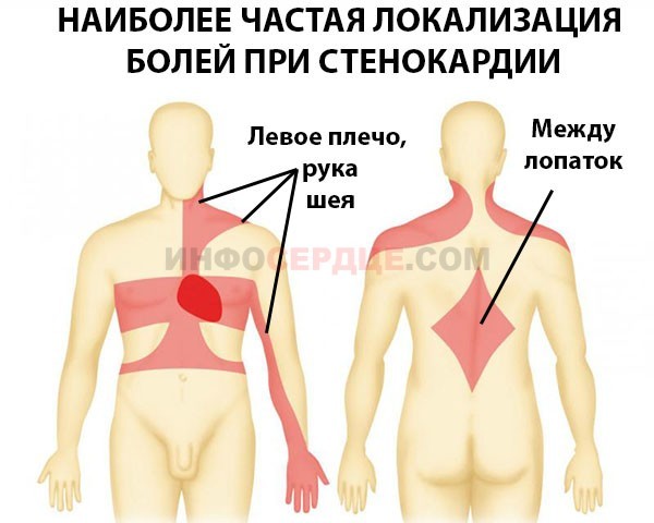 Что делать, если беспокоит жжение в области сердца