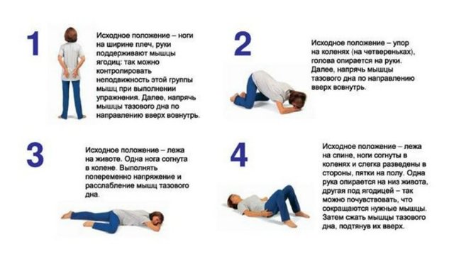 Как вправлять геморроидальные узлы