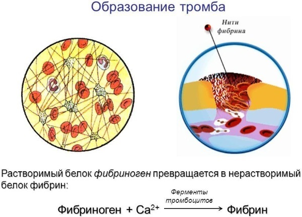 Фибриноген выше нормы – что это значит, что это такое, что делать? Фибриноген в крови – норма у женщин