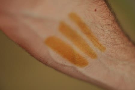 Лечение гипертонии йодом (по индийскому методу)