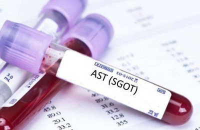 Что такое АЛТ в биохимическом анализе крови