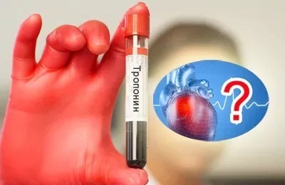 Анализы при стенокардии - общий анализ крови, холестерин, тропонины