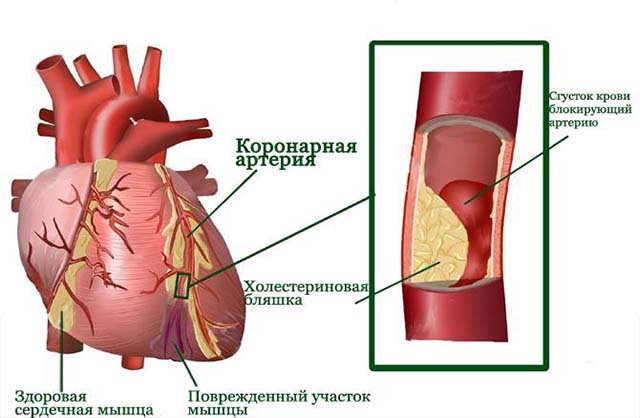 Опухла вена на пальце руки