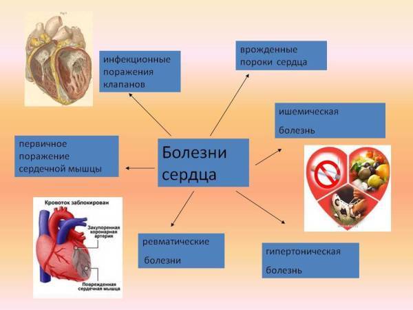 Болезни сердца: список и симптомы