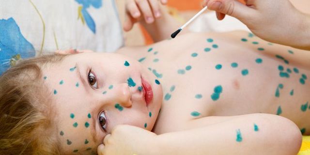 Какие бывают инфекционные заболевания?