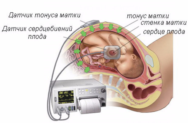 Сердцебиение плода норма ЧСС по неделям