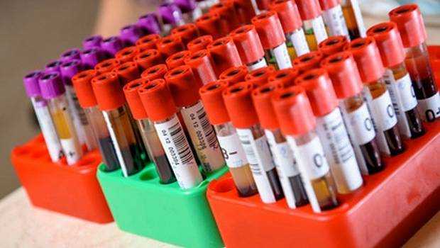 МНО крови: что показывает исследование и сколько стоит анализ на свертываемость крови?