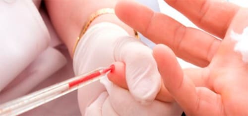 Что делать, если густая кровь при беременности? - Здоровая кровь