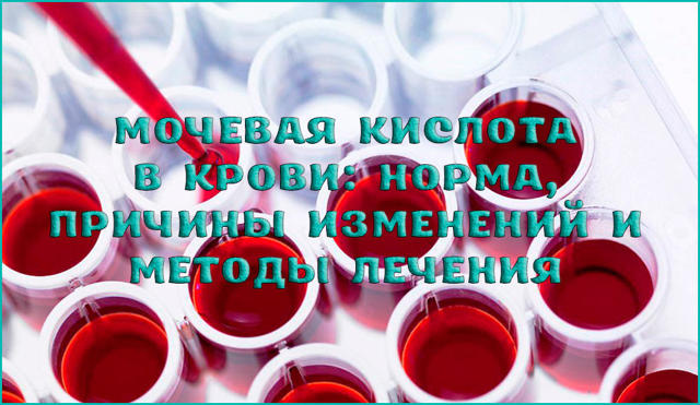 Мочевая кислота составляет уменя 755 что делать. Какая норма мочевой кислоты в крови мужчин, женщин и детей