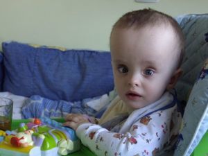 Асимметрия боковых желудочков мозга у детей и взрослых