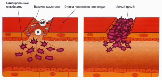 Повышены тромбоциты в крови - что это, как лечить, чем опасно