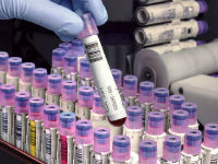 АСТ в крови – какова норма, причины повышения, что означает анализ крови АСТ?