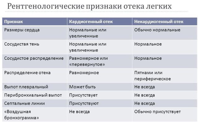 Кардиогенный отек легких - причины, симптомы, диагностика и лечение