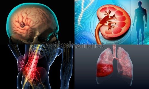 Уколы Дексаметазон: инструкция по применению внутримышечно