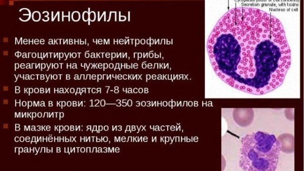 Эозинофилы повышены: патология или вариант нормы