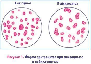Анизоцитоз эритроцитов и тромбоцитов: причины патологии