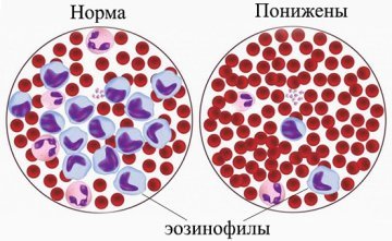 Эозинофилы в анализе как обозначаются