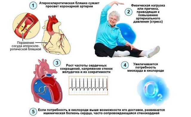 Ноющая боль в области сердца: причины и лечение
