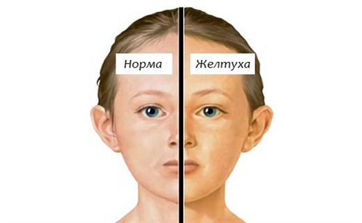 Щелочная фосфатаза - норма в крови у детей