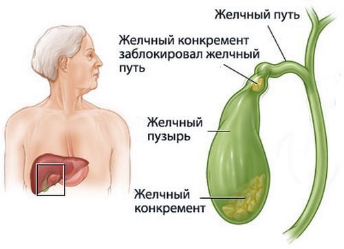 Боли под грудью: причины, диагностика и лечение