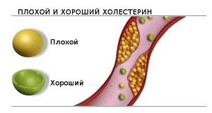 Препараты для снижения холестерина в крови: список и названия эффективных лекарственных средств
