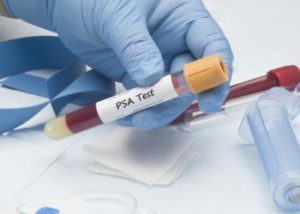 Анализ крови ПСА — что это такое? Расшифровка и норма